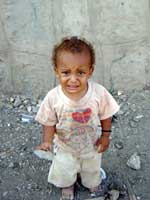 Yemen: Some 30 percent of children aged 2-5 severely stunted