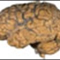 Study reveals a potential target for treating brain trauma
