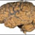 Higher prevalence of psychiatric symptoms found in children with epilepsy
