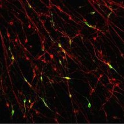 Dopamine neurons (in green) grown using stem cell technology.