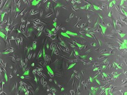 Brain cancer cells produce a green fluorescent protein. DNA encoded to produce the protein was delivered to the cancer cells by new freeze-dried nanoparticles produced by Johns Hopkins biomedical engineers. (Image: Stephany Tzeng)