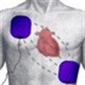 New method defibrillates heart with much less electricity - and pain