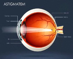 PE firm to launch their award winning digital eye test software at ODMA in Australia