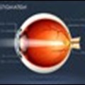 Eye Care Awareness Month