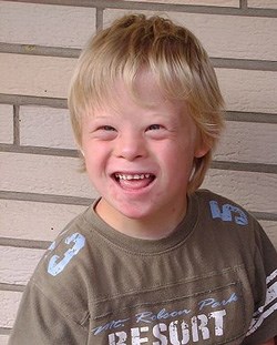 An 8-year-old boy with Down Syndrome. (Image: Vanellus Foto, via Wikimedia Commons)