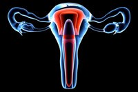 Tiny genetic variation can predict ovarian cancer outcome