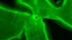 Timing is key in the proper wiring of the brain, Yale researchers find