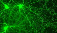 Three MCH neurons in the hypothalamus region of a mouse brain are highlighted in green. In animals, these neurons are associated with high calorie intake and lower energy levels. Yale researchers have shown how the effects of these key cells are reversed.