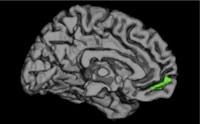 The brain, with the medial prefrontal cortex highlighted in green.