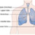 People fail to list persistent cough as a lung cancer warning