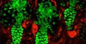 Yale researchers captured these images of hair follicles of a mouse, with nuclei of epithelial cells stained in green and mesenchymal cells, which are active in early development, in red. Yale scientists found that mesenchymal cells were crucial to hair growth. (Image courtesy of Dr. Pantelis Rompolas, Greco Lab, Yale School of Medicine)