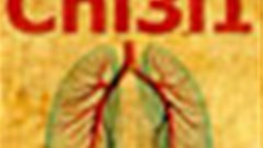 Yale scientists pinpoint key ingredient in fighting pneumonia