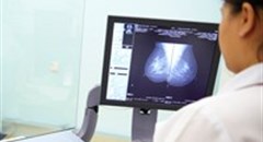 Scientists find sex hormones and breast cancer link in women under 50