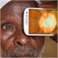 Transforming a smartphone into an eye test kit