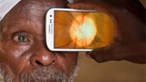 Transforming a smartphone into an eye test kit