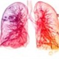 Lung disease and melanoma: a common molecular mechanism?