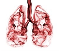 Pollution causes 8-year-old's lung cancer