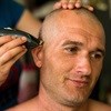 Highlighting health risks of the chiskop haircut
