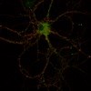 Scientists identify protein responsible for controlling communication between brain cells
