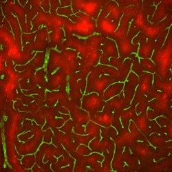 Excessive brain activity caused by stimuli such as repetitive sounds cause a reduction in blood vessels (green) in newborn mice and create areas of low oxygen content (red), Yale researchers have found. The researchers ask whether similar stimuli in human infants might cause long term damage in developing brains of human children.