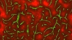 Repetitive sounds leave young brain starved for blood vessels