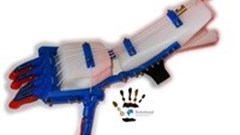 Robohand wins public support, Absa sponsorship