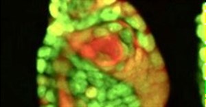 A key link between tumors and healthy tissue identified