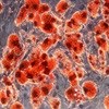 Deciphering the role of fat stem cells in obesity and diabetes