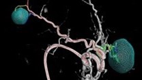 Philips launches live 3D image guidance tool for tumours