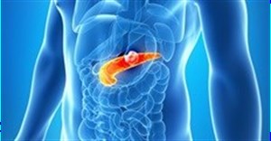 Long-term use of aspirin may reduce risk for pancreatic cancer