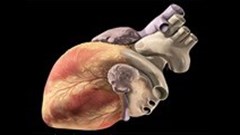 Chronic stress leads to increased risk of heart attacks and strokes