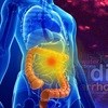 Yale study identifies potential bacterial drivers of inflammatory bowel disease