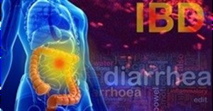 Yale study identifies potential bacterial drivers of inflammatory bowel disease