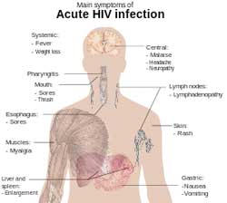 An illustration of the body showing where it is most vulnerable to HIV infections. Image: Wikipedia