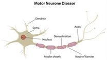 Wits profs will use new method to treat neuron diseases