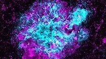 Failure of cells' 'garbage disposal' system may contribute to Alzheimer's