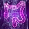 Screening for colorectal cancer vital to reduce mortality