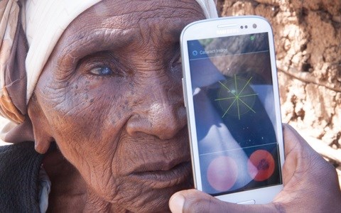 With a broad application, Peek Retina could have a huge impact with the potential to reduce global blindness by 80 percent. Credit: Peek Vision.