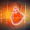 Real time tracking of acute myocardial infarction patients