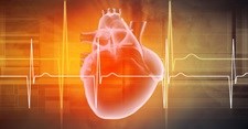Real time tracking of acute myocardial infarction patients