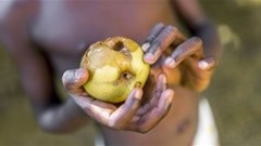 Africa has highest burden of foodborne diseases per population