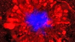 Research in the news: Hyperactive neurons may be culprit in Alzheimer's