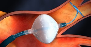 The new cryo-balloon allows the user to effectively measure the atrial fibrillation signals during ablation by bringing the catheter anatomically close to the veins’ muscular sleeve.