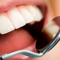 Minister to amend scope of dental therapists