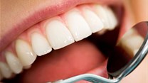 Minister to amend scope of dental therapists