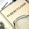 SU scientists develop a TB rapid screening test