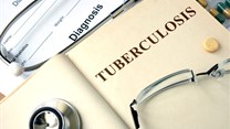 SU scientists develop a TB rapid screening test