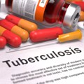New unit makes TB treatment safer for children
