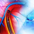 KZN specialists benefit from advanced cardiac training