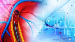 KZN specialists benefit from advanced cardiac training